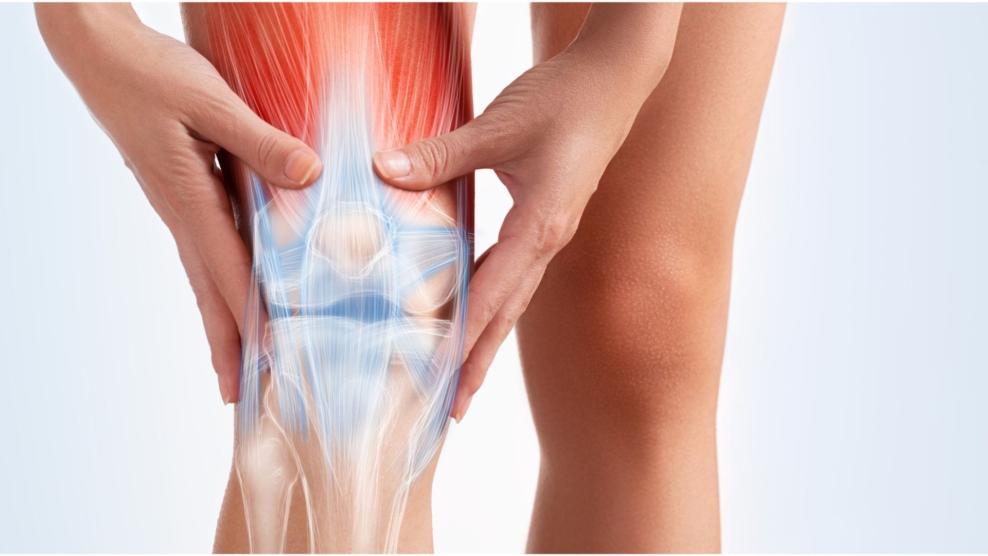 Knee Bursitis