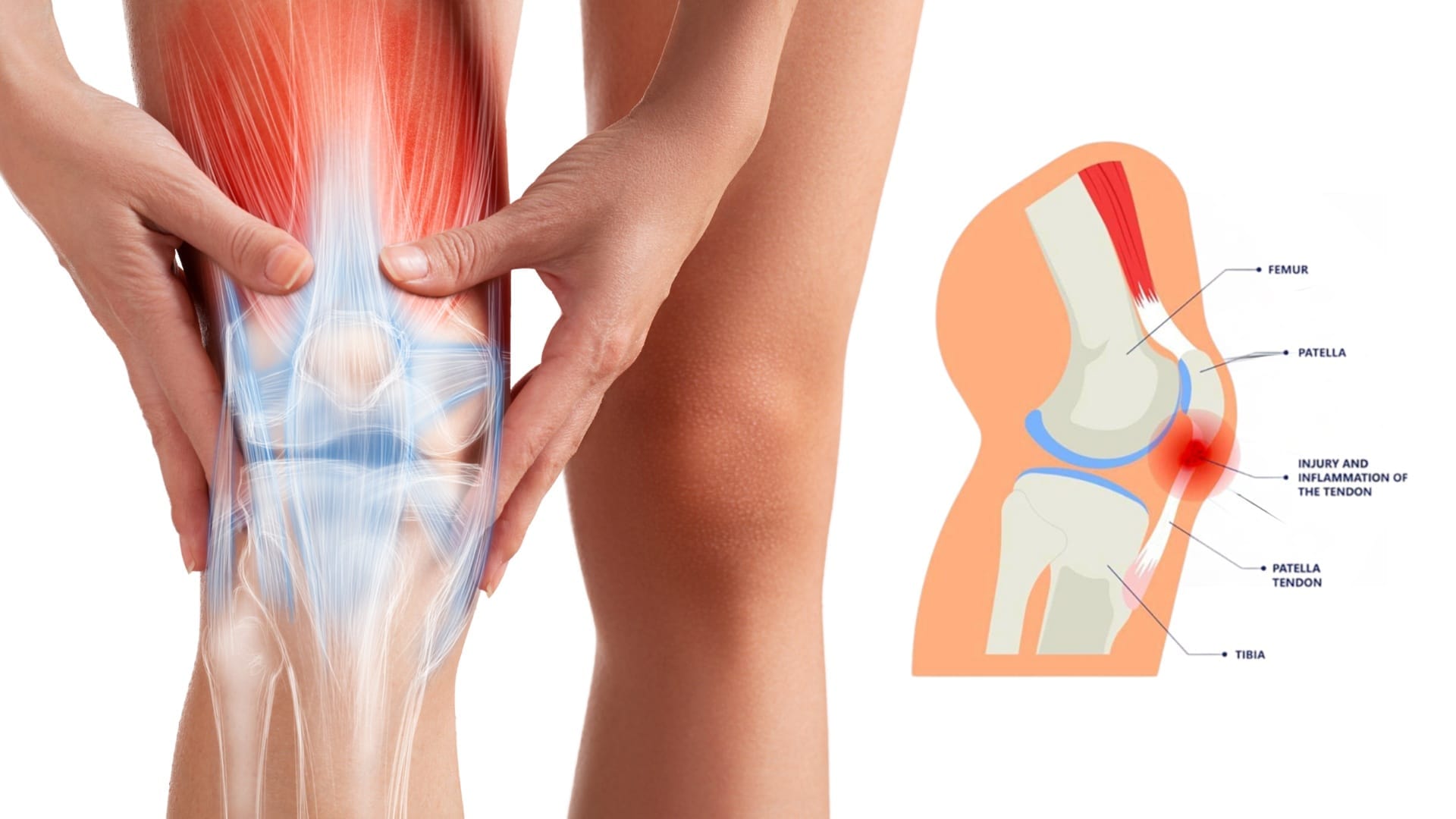 Knee Anatomy illustration
