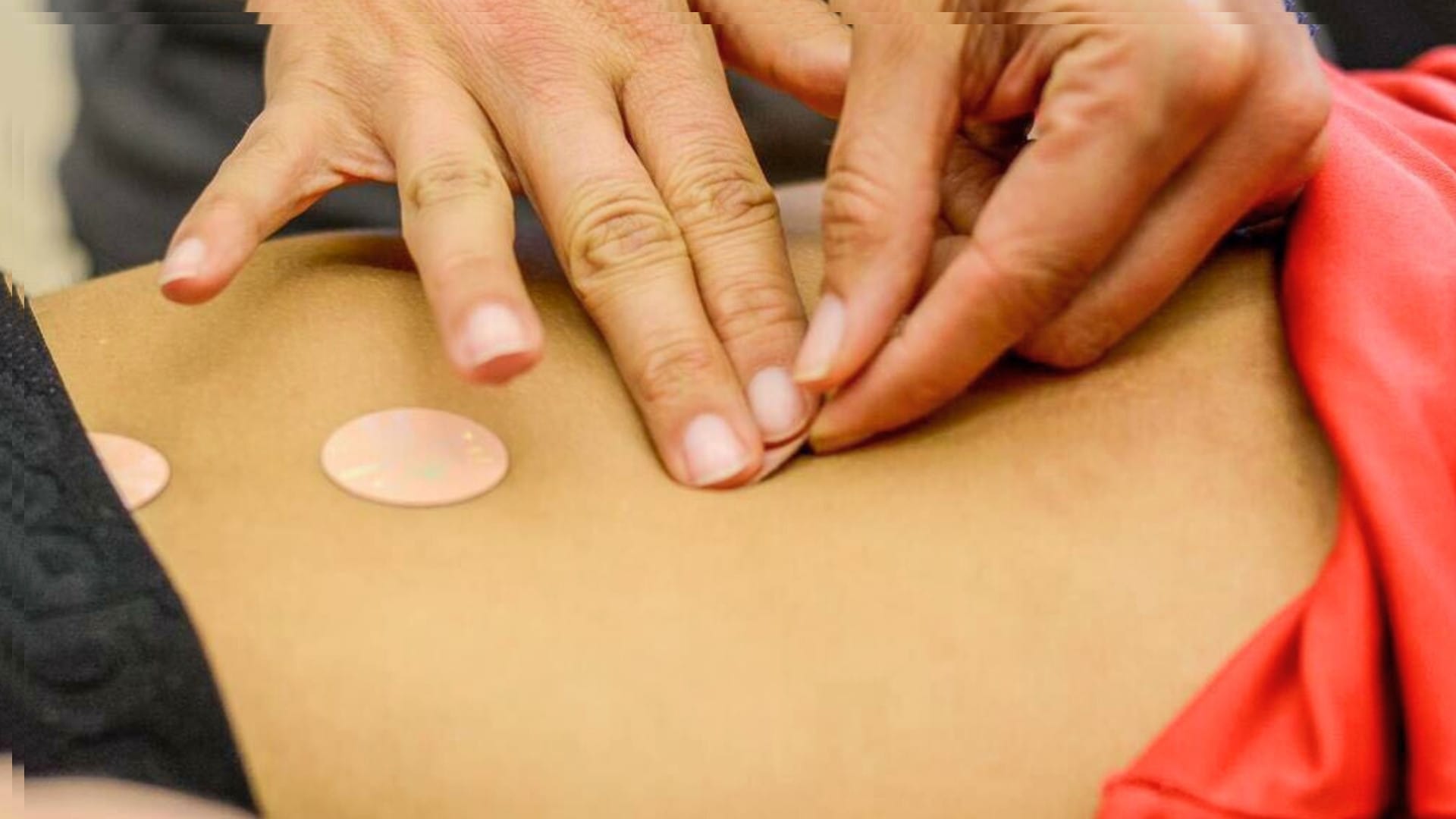 enthesopathy treatment