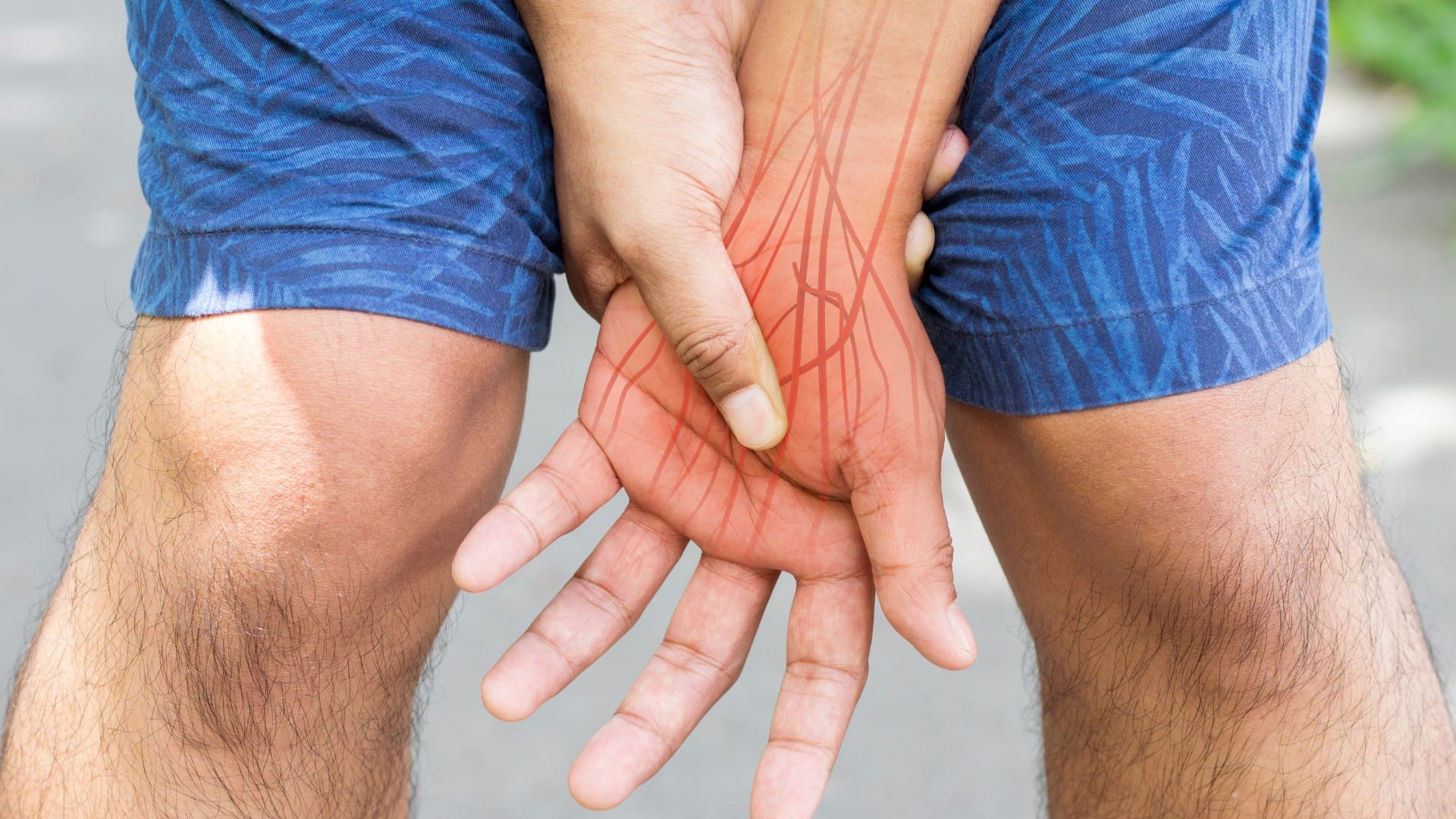 Can fibromyalgia cause neuropathy