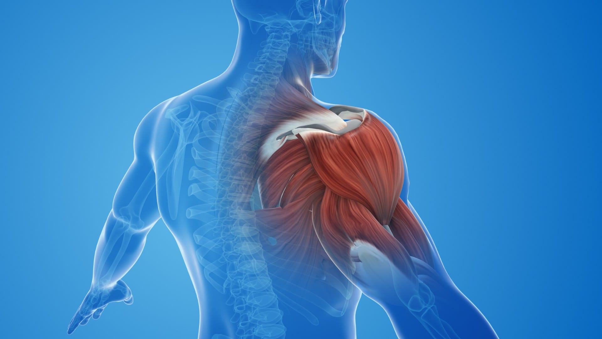 Vitamin D Deficiency Cause Fibromyalgia